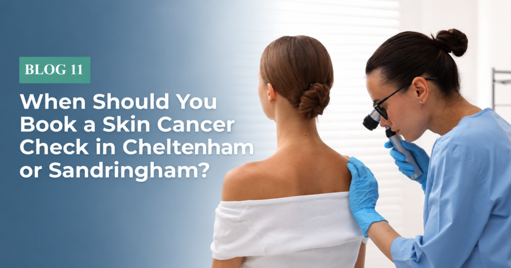 When Should You Get a Skin Cancer Check? | Cheltenham